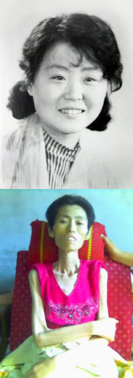 Wei Fengju prije nego što je bila mučena (gore), i 11. jula 2007., jedan dan prije smrti (dole).