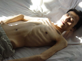 Omršavljen i umirući. Zhang Zhong nakon mučenja u zatvoru grada Daqing (juli 2004.)